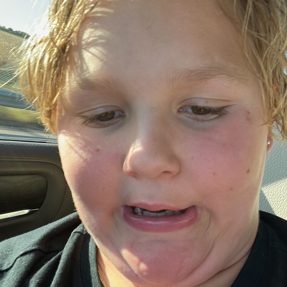 Hamburger - Picture 2 of 3